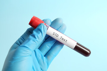Scientist holding tube with blood sample and label STD Test on light blue background, closeup