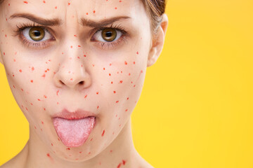 woman with red dots on her face skin problems dermatology dissatisfaction