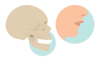 Jaw Surgery chin implant Sleep Apnea snoring upper airway plastic facial Cranio TMD TMJ joint Overbite teeth dental birth defects Open bite pain trauma cosmetic gummy smile bone reconstructive bad © Pepermpron