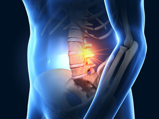 Painful lumbar spine joints, medical 3D illustration