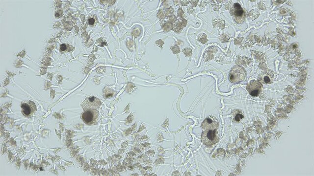Infusoria (Ciliophora) Peritrichia under microscope, order Sessilida, class Oligohymenophorea. Drops when in danger. Indian Ocean. Possibly family Zoothamniidae