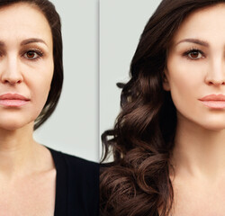 Aging. Mature woman-young woman.Face with skin problem.Showing photos before and after.