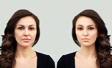 Aging. Mature woman-young woman.Face with skin problem.Showing photos before and after.