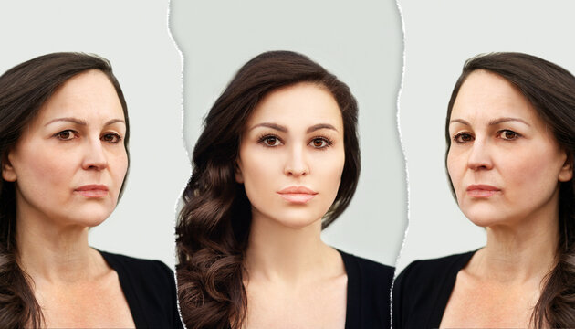 Aging. Mature woman-young woman.Face with skin problem.Showing photos before and after.
