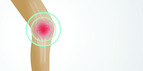 Knee painful. Joint pain. illustration medical concept on white background.