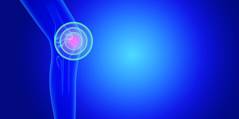 Knee Pain illustration on blue background. Skeleton medical concept.