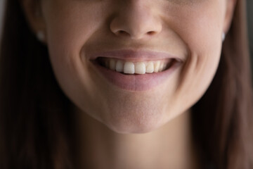 Extreme close up happy young woman showing perfect smile with white straight teeth, female...