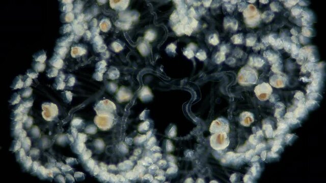 Infusoria (Ciliophora) Peritrichia under microscope, order Sessilida, class Oligohymenophorea. Drops when in danger. Indian Ocean. Possibly family Zoothamniidae