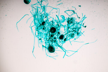 Characteristics of Rhizopus is a genus of common saprophytic fungi on Slide under the microscope...