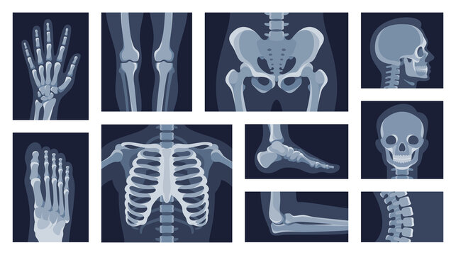 Collection different human body parts roentgen pictures vector flat illustration. Set x rays shot