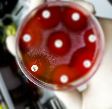 Antibiotic resistance test, selective focus show inhibition zone of against microbial agent.