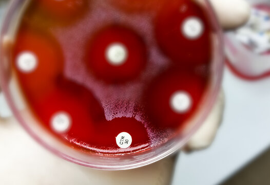 Antibiotic resistance test, selective focus show inhibition zone of ceftriaxone (CTR) against microbial agent.