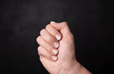 female hand with spoiled manicure, nails with peeled varnish on a black background