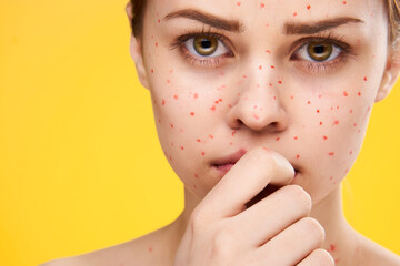 female face cropped view red dots on the face skin problems