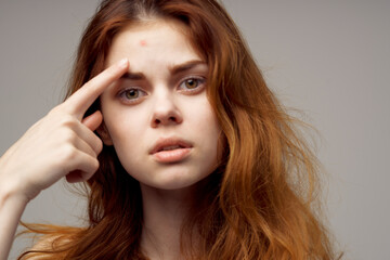 pretty woman facial skin problems dermatology close-up
