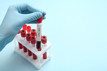 Scientist taking tube with blood sample and label STD Test from rack on light blue background,...