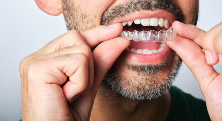 man with transparent dental retainer