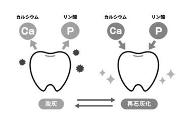 脱灰と再石灰化に関する歯のイラスト