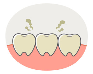 黄ばみに悩む歯や歯茎のシンプルで可愛いイラスト