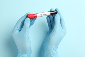 Scientist holding tube with blood sample and label STD Test on light blue background, top view