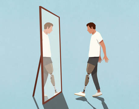 Male amputee with prosthetic limb standing at mirror
