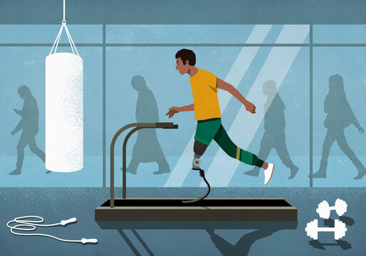 Male amputee with prosthetic leg jogging on treadmill at gym
