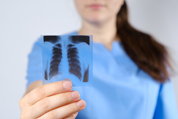 A doctor in a blue uniform shows a picture of a fluorogram of fluorography, an X-ray of the lungs for the prevention and early diagnosis of tuberculosis.