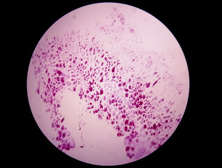 Gram staining, also known as Gram's method, is a method of differentiating bacterial species into two large groups (Gram-positive and Gram-negative). Here, Occasinal gram positive cocci are seen. 4X