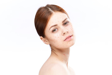 sad woman with bare shoulders red dots on her face