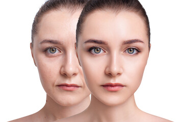 Beautiful woman face before and after lifting cosmetics procedure.