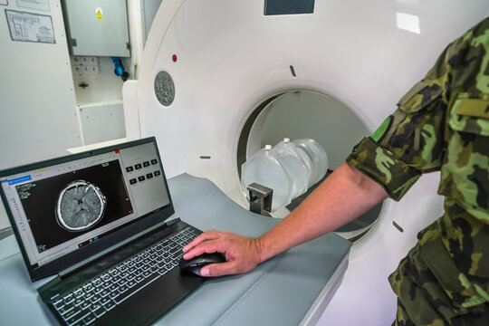 CT or computed tomography scanner inside army mobile field container ambulance, soldier showing patient with severe head trauma scan on laptop near