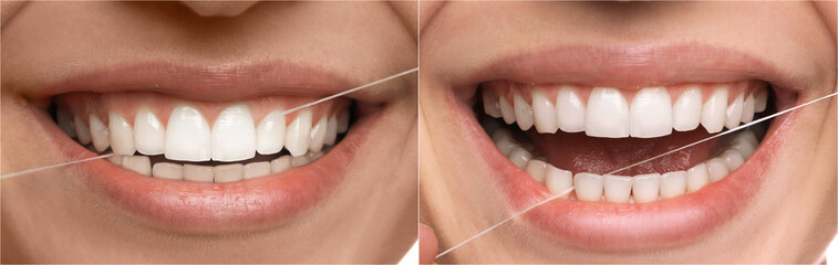 Collage with photos of woman using dental floss, closeup. Step by step instructions