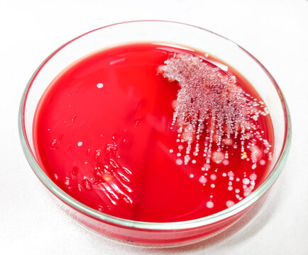 Staphylococcus aureus: Gram-positive bacteria, nonmotile, beta hemolysis, Staphylococcus growth on blood agar media