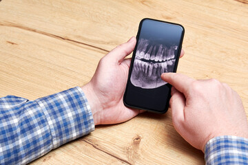 Man analyzing an x-ray picture of his teeth with an implant at home. Dental clinic and orthodontic...