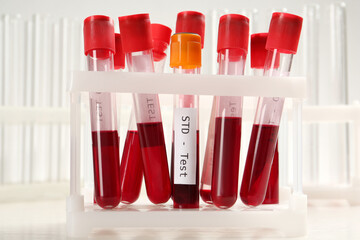 Tubes with blood samples in rack on white background. STD test - obrazy, fototapety, plakaty
