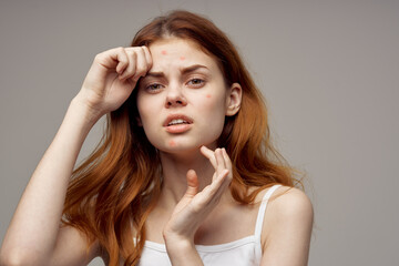 Fototapeta premium beautiful woman in a white t-shirt pimples on the face light background