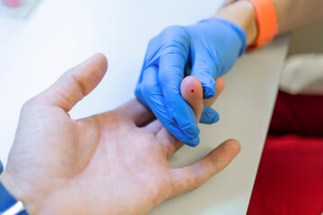 Blood medical test. Taking a blood sample from male finger in hospital.