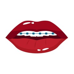 Vector illustration of lips and teeth with braces. Dentistry illustration.