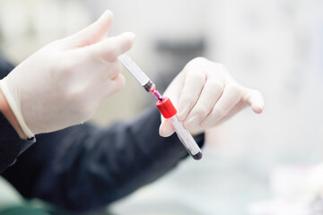 hand glove drawblood sample inside for test