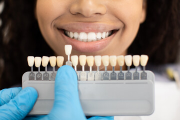 Unrecognizable Dentist Choosing Right Emanel Color For Black Female Patient In Clinic