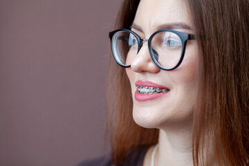 The smile of a young and beautiful girl with braces on her white teeth. Straightening of crooked...