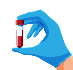 Test Tube with Blood Sample in Hand of Doctor