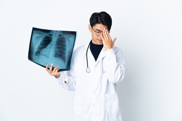 Young Chinese doctor man holding radiography isolated on white background with tired and sick...