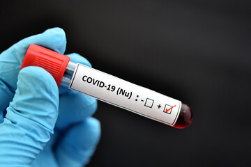 Obraz premium Nu variant COVID-19 positive, blood sample positive with Nu or B.1.1.529 variant of COVID-19 coronavirus