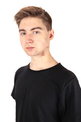 Fototapeta premium Portrait of a teenager, boy in puberty isolated on a white background