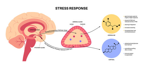 Stress responce system - 471570260