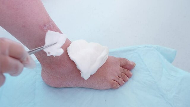 female doctor assistant examines and treats leg woman with scratches, scars, eczema, skin flayed on lower leg, wounds are bleeding, concept of medical care, scratching sores, self-harm