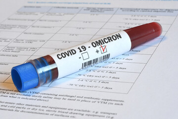 Blood tube for test detection of virus Covid-19 Omicron Variant with positive result on papers...