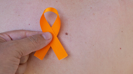 December orange	. holding an orange tape over the skin with spots. campaign to prevent skin cancer,...