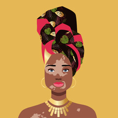 Isolated portrait of an African woman with vitiligo on the skin. The concept of body positivity, self-acceptance, different beauty. World Vitiligo Day. Stock vector illustration in flat style.